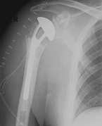 Abbildung11 Abbildung11